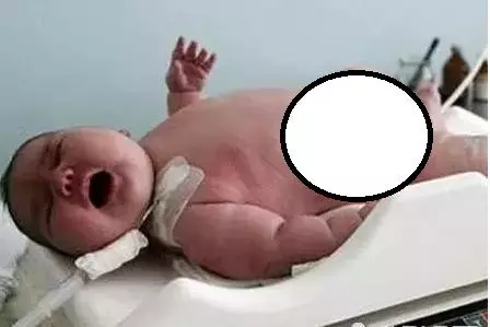 有夠扯!澳洲600斤肥妹臨盆!還要出動飛機載她!孩子出生後模樣嚇到護士!
