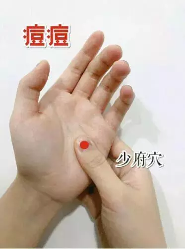老中醫穴位乾貨,治療生活小毛病,很實用