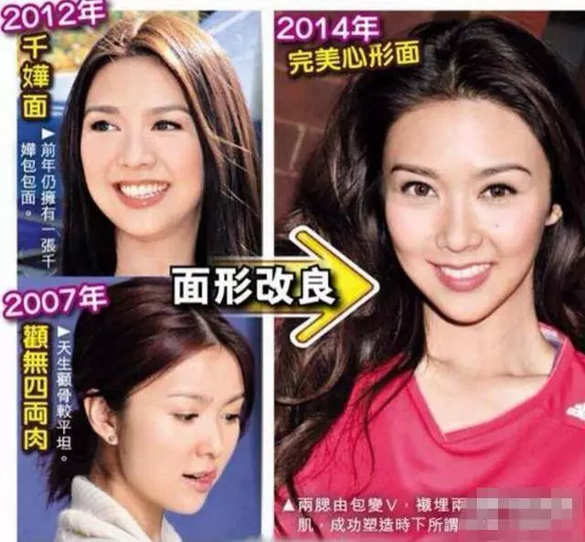 薛凱琪硬生生地把自己整成了「臉長長的Barbie Doll」?! 僵硬到笑容動彈不得, 好懷念以前她可愛的~臉
