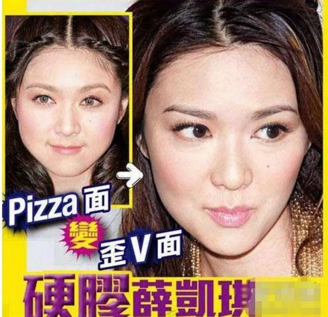 薛凱琪硬生生地把自己整成了「臉長長的Barbie Doll」?! 僵硬到笑容動彈不得, 好懷念以前她可愛的~臉