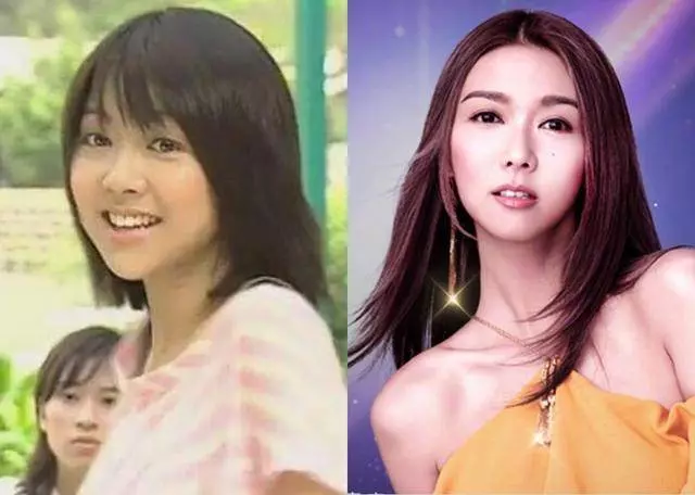 薛凱琪硬生生地把自己整成了「臉長長的Barbie Doll」?! 僵硬到笑容動彈不得, 好懷念以前她可愛的~臉