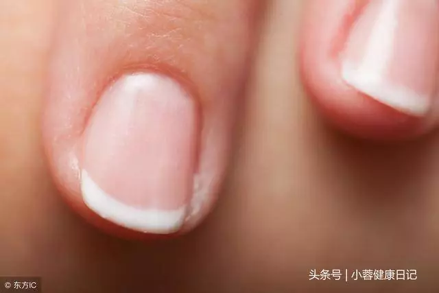 肝好不好,看這些地方有沒有「變黑」!枸杞換一種吃法最養肝...