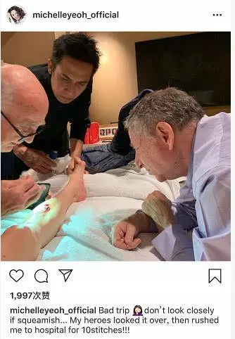 楊紫瓊腿部受傷縫針,曬照曝光其變形腳掌,73歲男友表現擔憂