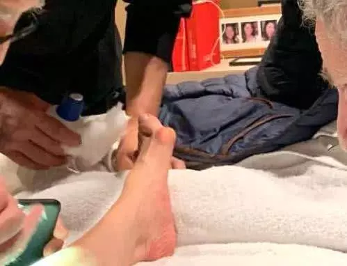 楊紫瓊腿部受傷縫針,曬照曝光其變形腳掌,73歲男友表現擔憂