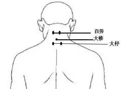 頭項尋列缺頭疼類疾病列缺穴來治療