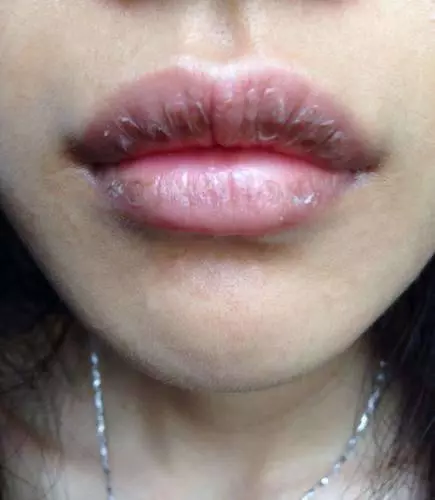 以下5個表現,說明你的肝臟已經受損了!肝臟受損,謹記飯後「一坐一閉」,睡前「三不要」