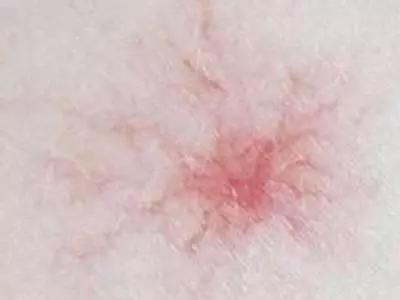以下5個表現,說明你的肝臟已經受損了!肝臟受損,謹記飯後「一坐一閉」,睡前「三不要」