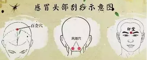 感冒、咳嗽、高燒,這樣刮一刮,就完事!收了吧!