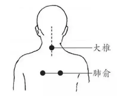 感冒、咳嗽、高燒,這樣刮一刮,就完事!收了吧!