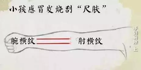 感冒、咳嗽、高燒,這樣刮一刮,就完事!收了吧!