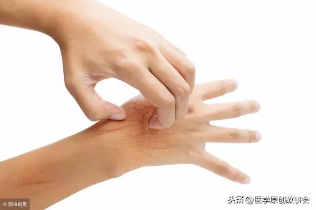 手指出現三個徵兆的時候,最好去檢查一下,血栓可能已經找上你