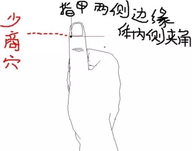 少商穴:喉嚨腫痛、感冒、發熱、咳嗽、點刺放血,退燒立竿見影!