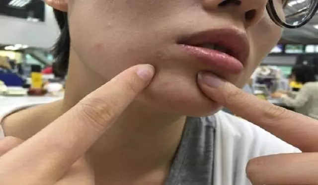 體內濕氣過重,每天揉壓拍腿幾分鐘,除濕去酸沉還瘦腿