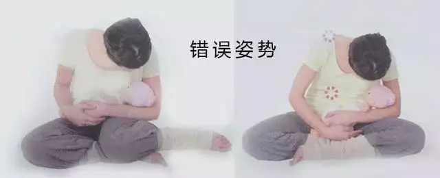 生娃後,為什麼媽媽們都喊「腰痛」?若你以為是「麻醉針」惹的禍,那就錯了!