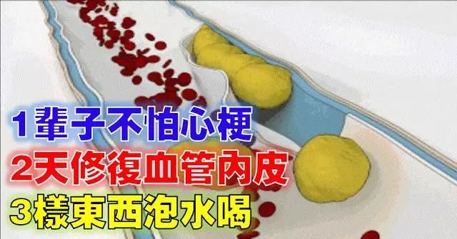 心內科主任推薦!3種東西泡水喝,2天修護血管內皮,1輩子不怕心梗~