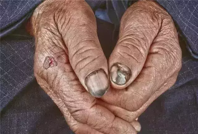 孫子把85歲的爺爺接到廈門,拍了一組照片,結果帥遍頭條