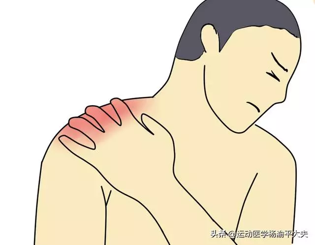 得了肩周炎吃藥、按摩、貼膏藥管用嗎?一文詳解肩周炎的治療方法