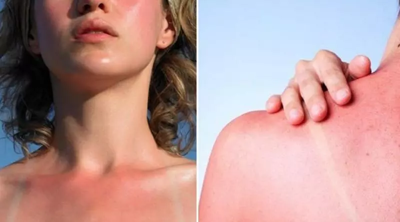 90%的雷擊不會奪命!18個「今天才知道」的超驚奇人體事實