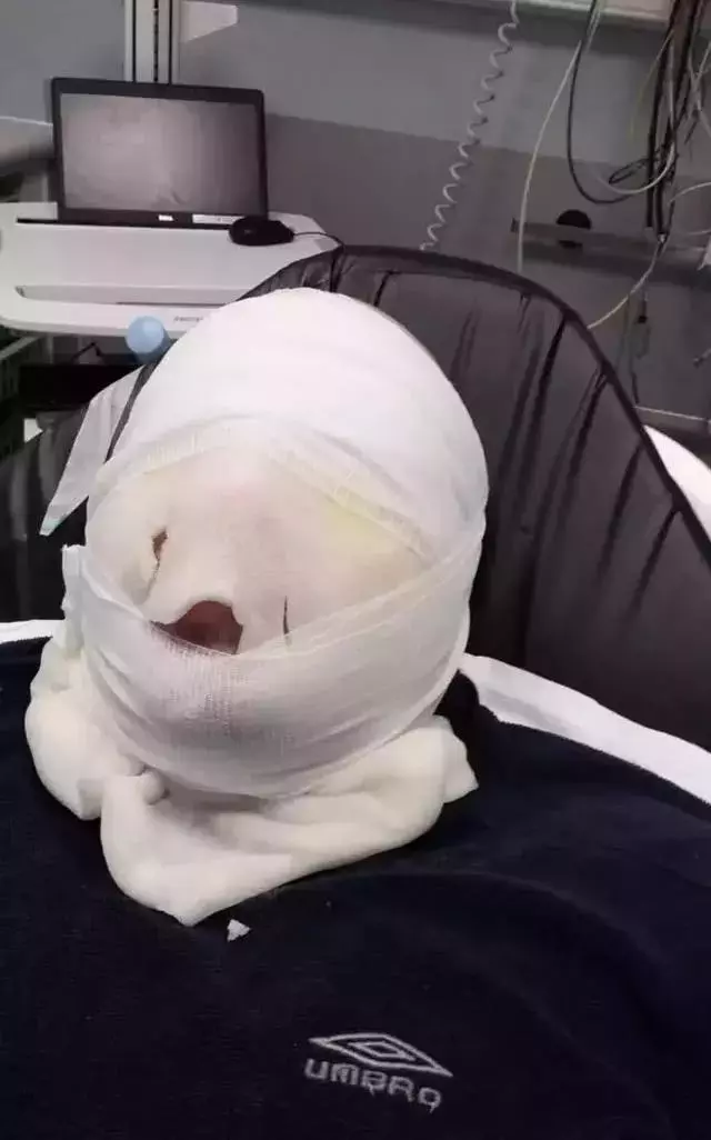 還在用微波爐加熱這些?這份易燃易爆危險名單快收好!
