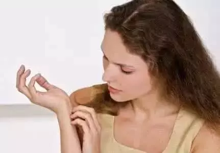 你以為身上的包是蚊子咬的?其實並不是!如果你家有,趕快清理掉!