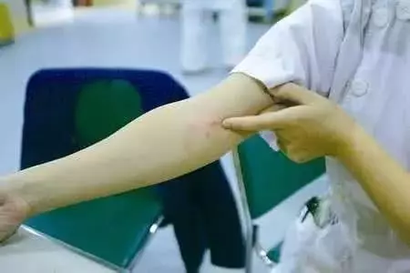 你以為身上的包是蚊子咬的?其實並不是!如果你家有,趕快清理掉!