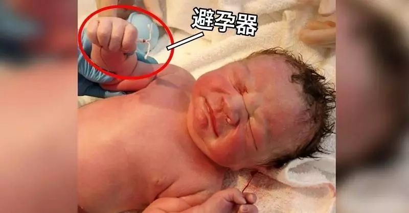 地表最強嬰兒!小男嬰「手抓著媽媽避孕器」強勢出生,照片秒飆破7萬人按讚:1%的奇蹟!