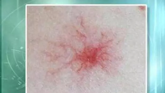 這2種食材是肝的「救命鑰匙」,多吃一口,肝毒最少一點