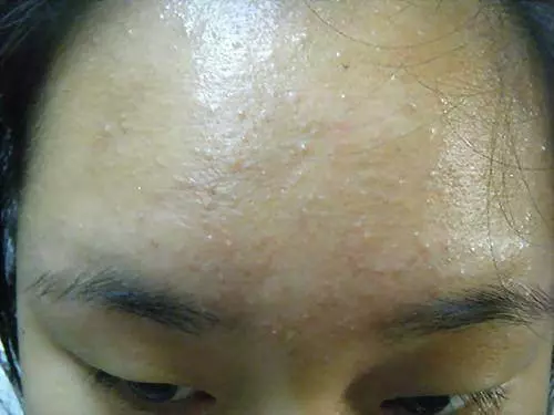 這2種食材是肝的「救命鑰匙」,多吃一口,肝毒最少一點