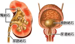 黑木耳配「這個東西」,幫助你排出體內肥油!太有用了!