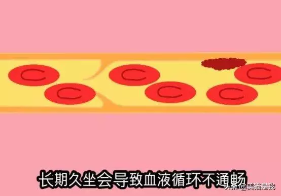 3招叫停腰痛,讓你腰部活力如初,擁有少女腰!