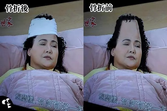 5 個「如果把頭髮剃掉的話」會變醜八怪的人物,小蘭姐姐第一名!