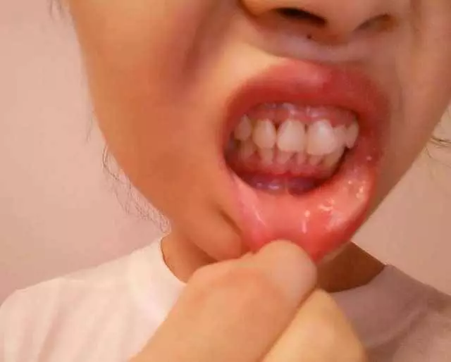 要預防肝臟受損,這「3種食物」千萬不能吃,吃一次,對肝臟的傷害就多一次