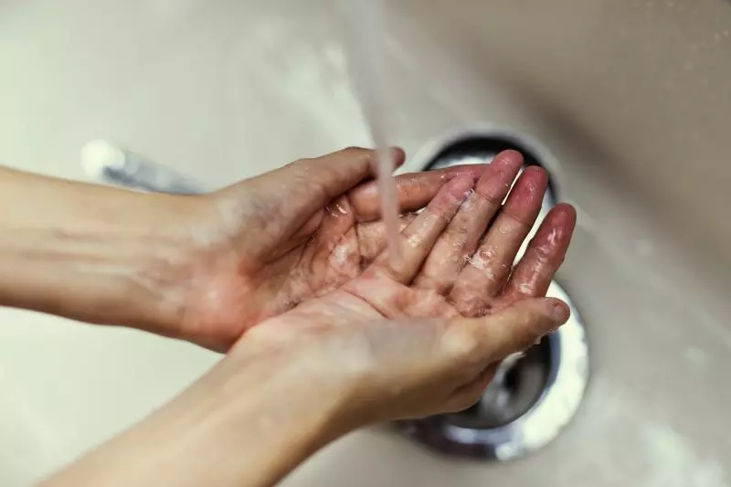 用公廁洗手乳染菌爆長血瘡!她「殭屍上臉」...右半邊現粉褐色坑洞