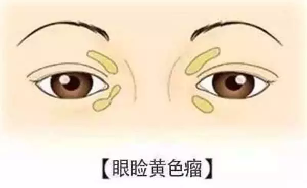 「心臟!」好不好,看臉就知道,有這10種症狀的人要注意,尤其是第三種要特別小心!