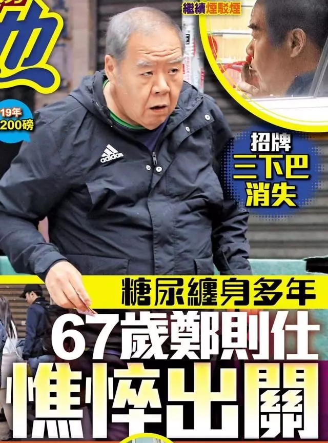 肥貓鄭則仕受糖尿病纏身,日漸消瘦頭髮斑白身體堪憂!
