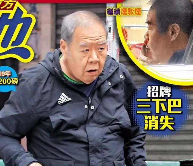 肥貓鄭則仕受糖尿病纏身,日漸消瘦頭髮斑白身體堪憂!