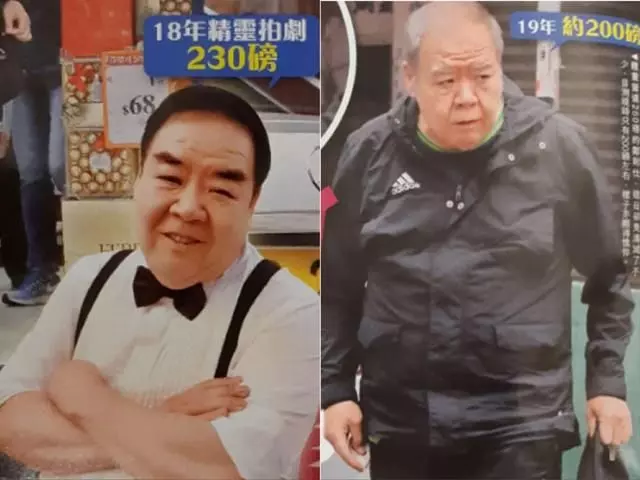 肥貓鄭則仕受糖尿病纏身,日漸消瘦頭髮斑白身體堪憂!