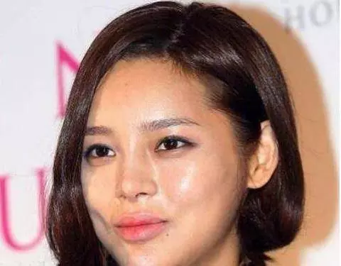 被「整容」毀掉的4位女明星,有一個整成面癱臉,而她不幸去世!