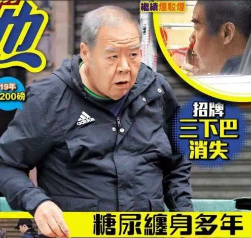 鄭則仕一年暴瘦27斤,虧損1700萬,小14歲嬌妻仍不離不棄