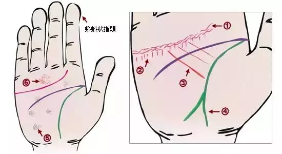 做自己的醫生:24種身心問題的手診圖解,收了吧!