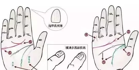 做自己的醫生:24種身心問題的手診圖解,收了吧!