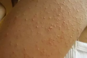 優酪乳這樣喝竟然就能狂瘦20斤!! 趁現在把肥油都甩了吧!! 我要趕緊收藏~