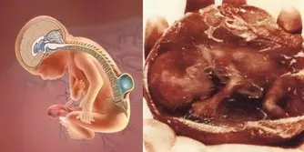 優酪乳這樣喝竟然就能狂瘦20斤!! 趁現在把肥油都甩了吧!! 我要趕緊收藏~