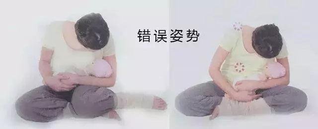 生娃後,為什麼媽媽們都喊「腰痛」?若你以為是「麻醉針」惹的禍,那就錯了!