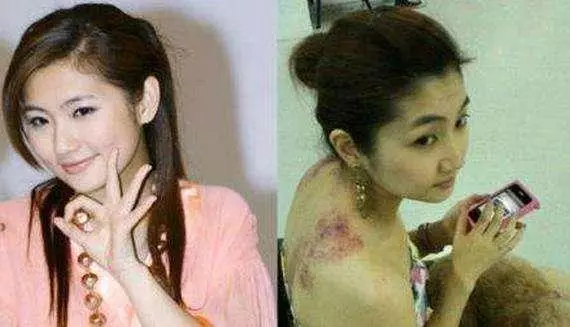 任家萱重度燒傷後都用美顏濾鏡自拍,與外婆合照臉上褶子都磨平了!