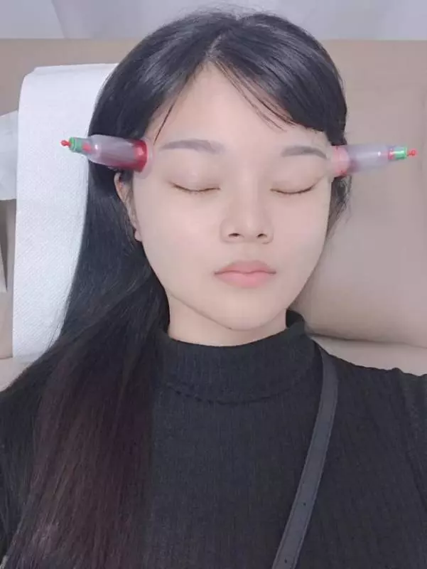 【大馬偏頭痛神醫!】一個療程只需RM50!網友放血2次後,不再頭痛連止痛藥也不用吃了