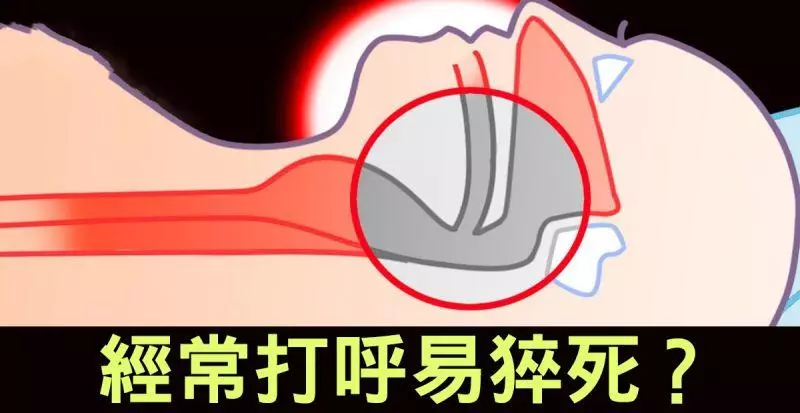 睡不好會要命!經常「打呼」腦栓塞風險多10倍!暢通氣管「六步驟」睡好睡滿