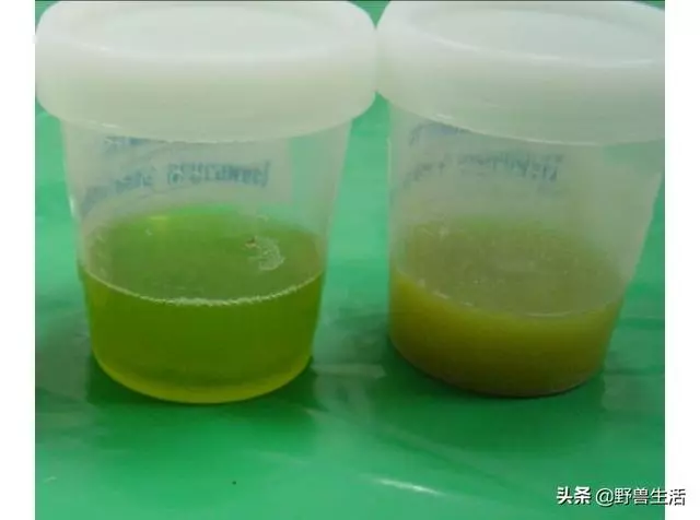 大便是健康的晴雨表!專家提醒:大便出現這些顏色,你要警惕了