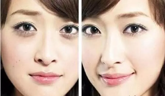 手上有個「美容穴」,每天堅持1分鐘,皮膚嫩白無雀斑