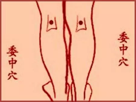 遇冷後發生的腰痛,中醫治療簡單還省錢